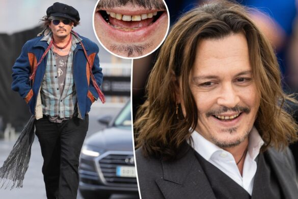 Johnny Depp’s teeth ‘rot’ is actually ‘aggressive’ wear: celebrity ...